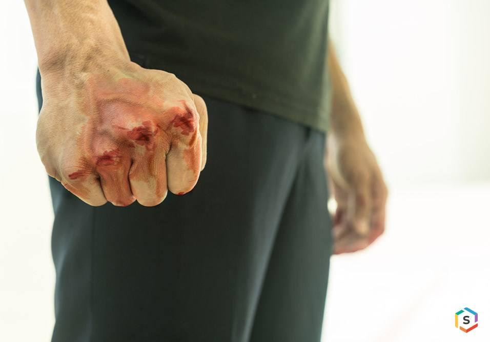 Violência em condomínios: como transformar um “microcosmo da crise” em um pacto ativo de proteção